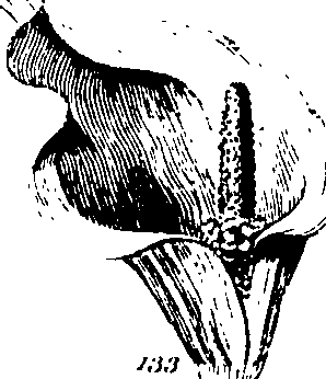 061/061920080104830_7.png