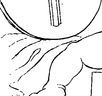 103/103890080000460_0.png