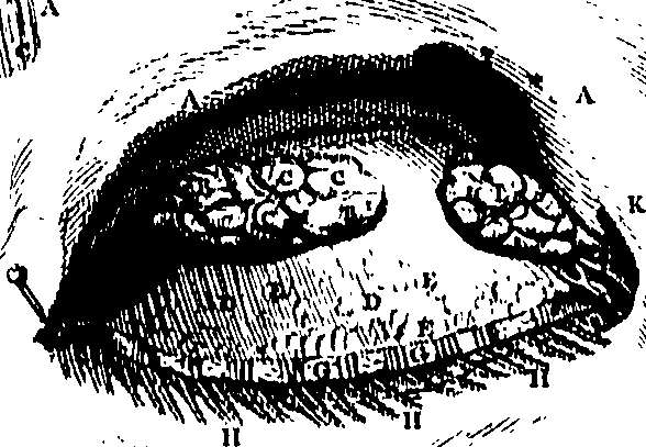 104/104620030000430_1.png