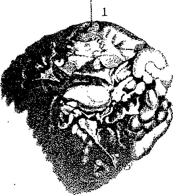 115/115140110000430_1.png