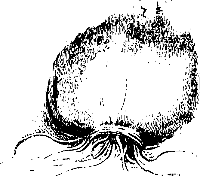115/115850020100440_0.png
