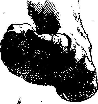 119/119210110000160_1.png