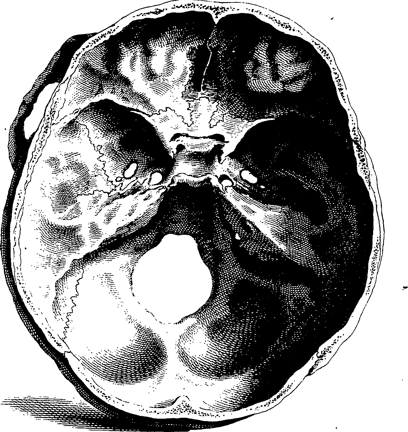 122/122130030000080_1.png
