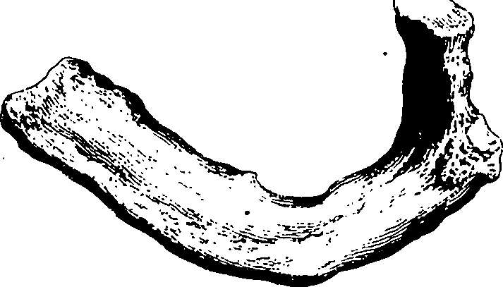 122/122130030000150_1.png