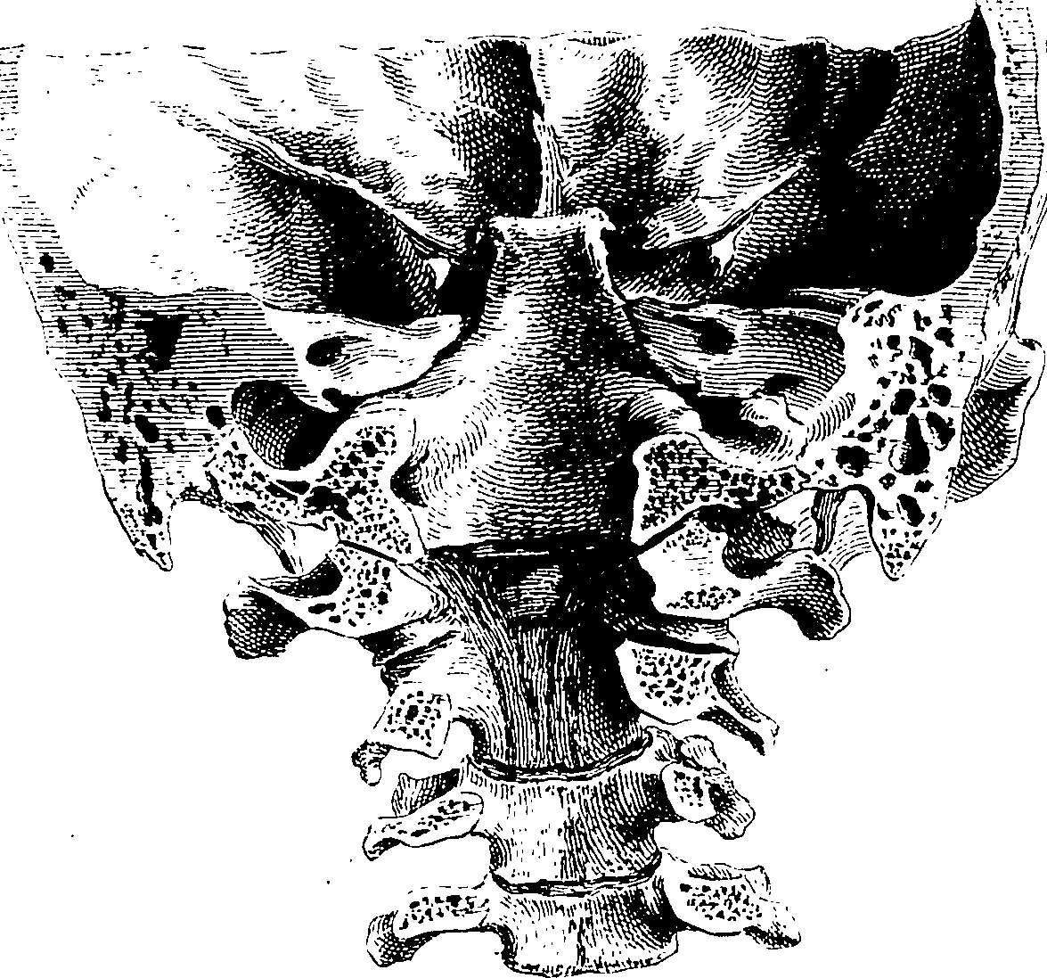 122/122130030000390_1.png