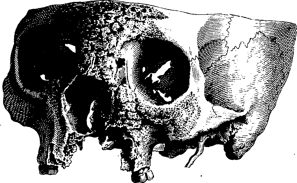 122/122130030000420_1.png