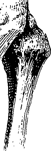 122/122130030000500_1.png